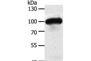 Western Blot analysis of Mouse heart tissue using MAP4K3 Polyclonal Antibody at dilution of 1:400 (MAP4K3 Antikörper)