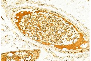 ABIN6264369 and ABIN6268848 at 1/100 staining Human normal tissues adjacent to colorectal cancer by IHC-P.