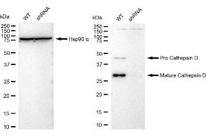 Western blotting analysis using Cathepsin D antibody (ABIN7797938). (Rekombinanter Cathepsin D Antikörper)