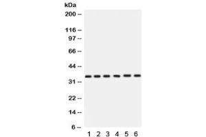Western blot testing of 1) rat stomach, 2) rat thymus, 3) human HeLa, 4) A549, 5) SKOV and 6)  22RV1 with Cdk4 antibody. (CDK4 Antikörper  (AA 201-303))