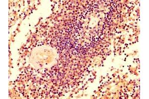 IHC image of ABIN7145433 diluted at 1:500 and staining in paraffin-embedded human spleen tissue performed on a Leica BondTM system. (GRK2 Antikörper  (AA 2-221))