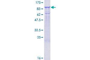 MX1 Protein (AA 1-662) (GST tag)