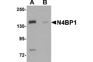 Western blot analysis of N4BP1 in HeLa cell lysate with N4BP1 antibody at 0.