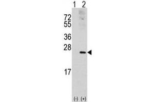 Western blot analysis of RAC1 antibody and 293 cell lysate (2 ug/lane) either nontransfected (Lane 1) or transiently transfected with the RAC1 gene (2). (RAC1 Antikörper  (AA 49-78))