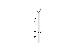 Anti-GRINA Antibody (Center) at 1:1000 dilution + human lung lysate Lysates/proteins at 20 μg per lane. (GRINA Antikörper  (AA 117-146))