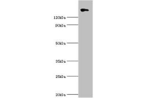 Western blot All lanes: Collagen alpha-1 (II) chain antibody at 10 μg/mL + 293T whole cell lysate Secondary Goat polyclonal to rabbit IgG at 1/10000 dilution Predicted band size: 142, 135, 30 kDa Observed band size: 142 kDa (COL2A1 Antikörper  (AA 1228-1487))