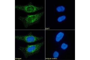 Immunofluorescence staining of HeLa cells using anti-CD171. (Rekombinanter L1CAM Antikörper)