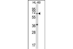 Western blot analysis in HL-60 cell line lysates (35ug/lane). (PKMYT1 Antikörper  (N-Term))