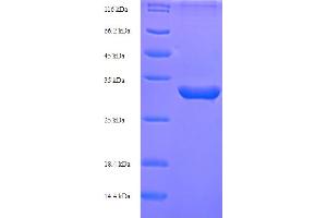 SDS-PAGE (SDS) image for Inhibin, alpha (INHA) (AA 227-360) protein (His-SUMO Tag) (ABIN5709759) (Inhibin alpha Protein (AA 227-360) (His-SUMO Tag))
