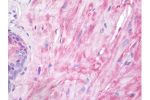 Human Prostate, Smooth Muscle: Formalin-Fixed, Paraffin-Embedded (FFPE) (Vinculin Antikörper  (AA 356-607))