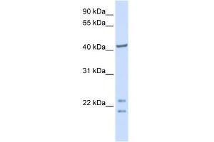 WB Suggested Anti-C16orf48 Antibody Titration:  0.