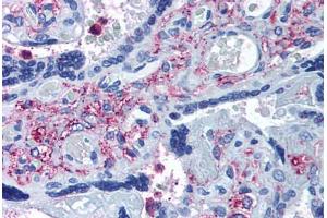 Immunohistochemistry (IHC) image for anti-ADAM Metallopeptidase with thrombospondin Type 1 Motif, 5 (ADAMTS5) (Internal Region) antibody (ABIN1048292)