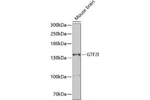 Western blot analysis of extracts of Mouse brain using GTF2I Polyclonal Antibody at dilution of 1:500. (GTF2I Antikörper)