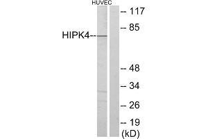 Western blot analysis of extracts from HUVEC cells, using HIPK4 antibody. (HIPK4 Antikörper  (C-Term))