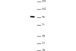 GLIS1 antibody (mAb) tested by Western Blot. (GLIS1 Antikörper  (N-Term))