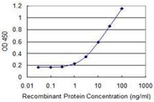 Detection limit for recombinant GST tagged AGPAT6 is 0. (AGPAT6 Antikörper  (AA 39-137))