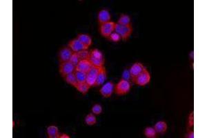 Immunofluorescence (IF) image for anti-Cadherin 1, Type 1, E-Cadherin (Epithelial) (CDH1) antibody (Alexa Fluor 594) (ABIN2656828)