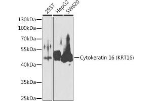 Western blot analysis of extracts of various cell lines, using Cytokeratin 16 (KRT16) antibody (ABIN6129541, ABIN6143021, ABIN6143022 and ABIN6223391) at 1:1000 dilution.