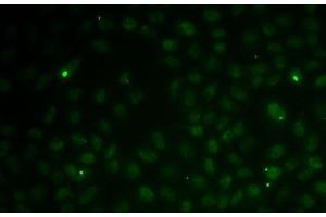 Immunofluorescence analysis of MCF7 cells using RAD51C Polyclonal Antibody (RAD51C Antikörper)