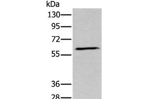 Western blot analysis of Human fetal brain tissue lysate using GPC5 Polyclonal Antibody at dilution of 1:450 (GPC5 Antikörper)
