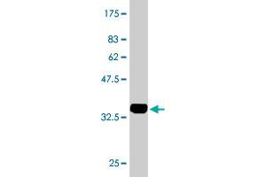 Western Blot detection against Immunogen (34. (LASS4 Antikörper  (AA 57-139))