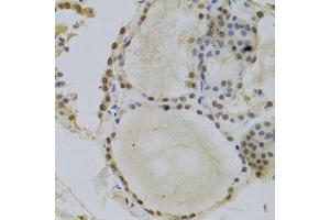 Immunohistochemistry (Paraffin-embedded Sections) (IHC (p)) image for anti-Hepatoma-Derived Growth Factor (HDGF) (AA 1-240) antibody (ABIN6141694)