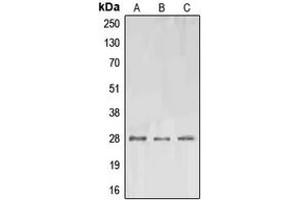 Western blot analysis of EPO expression in A549 (A), SP2/0 (B), PC12 (C) whole cell lysates. (EPO Antikörper  (Center))