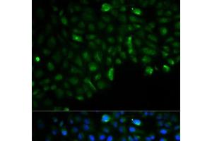 Immunofluorescence analysis of U2OS cells using HK2 Polyclonal Antibody (Hexokinase 2 Antikörper)