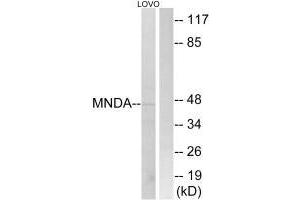 Western blot analysis of extracts from LOVO cells, using MNDA antibody. (MNDA Antikörper  (C-Term))