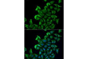 Immunofluorescence analysis of A549 cells using FABP5 antibody. (FABP5 Antikörper  (AA 1-135))