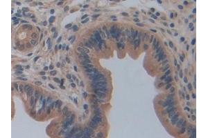 Immunohistochemistry (IHC) image for anti-Caspase 12 (Gene/pseudogene) (CASP12) (AA 1-413) antibody (ABIN7442993)