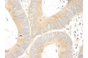 Immunohistochemistry (IHC) image for anti-ATP-Binding Cassette, Sub-Family F (GCN20), Member 1 (ABCF1) (AA 150-200) antibody (ABIN7453858)