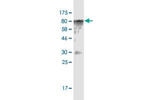 Western Blot detection against Immunogen (82. (CAMKK1 Antikörper  (AA 1-520))