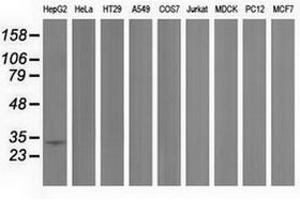 Image no. 1 for anti-Peroxisomal Trans-2-Enoyl-CoA Reductase (PECR) antibody (ABIN1500149) (PECR Antikörper)