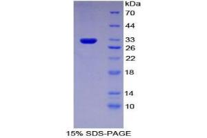 SDS-PAGE analysis of Mouse Multidrug Resistance-Associated Protein 1 Protein.