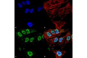 Immunocytochemistry/Immunofluorescence analysis using Mouse Anti-Cav3. (CACNA1G Antikörper  (AA 2052-2172) (HRP))