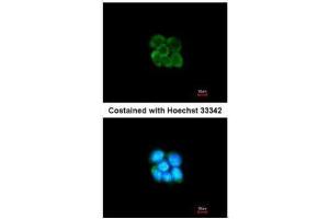 ICC/IF Image Immunofluorescence analysis of methanol-fixed A431, using SERPINF2, antibody at 1:200 dilution. (alpha 2 Antiplasmin Antikörper  (Center))