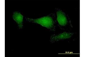 Immunofluorescence of purified MaxPab antibody to APPL2 on HeLa cell. (APPL2 Antikörper  (AA 1-664))