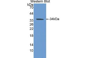 Western blot analysis of the recombinant protein. (CA5B Antikörper  (AA 34-317))