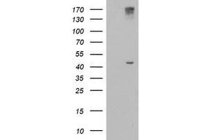Western Blotting (WB) image for anti-1-Acylglycerol-3-Phosphate O-Acyltransferase 5 (Lysophosphatidic Acid Acyltransferase, Epsilon) (AGPAT5) antibody (ABIN1496501) (AGPAT5 Antikörper)