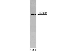 Western blot analysis of GGA2 on a EB-1 cell lysate (Human B lymphoblast, Burkitt's lymphoma, ATCC HTB-60).