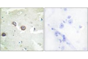 Immunohistochemistry (IHC) image for anti-Cadherin 4 (CDH4) (AA 731-780) antibody (ABIN2889886) (Cadherin 4 Antikörper  (AA 731-780))