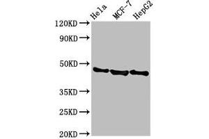 Western Blot Positive WB detected in: Hela whole cell lysate, MCF-7 whole cell lysate, HepG2 whole cell lysate All lanes: BFSP2 antibody at 3. (BFSP2 Antikörper  (AA 11-110))