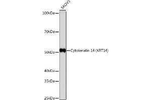 Western blot analysis of extracts of SKOV3 cells, using Cytokeratin 14 (KRT14) (KRT14) antibody (ABIN7268091) at 1:1000 dilution. (KRT14 Antikörper)