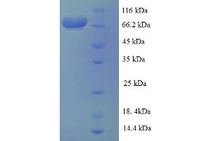 SDS-PAGE (SDS) image for V-Akt Murine Thymoma Viral Oncogene Homolog 1 (AKT1) (AA 1-480), (full length) protein (GST tag) (ABIN5712998) (AKT1 Protein (AA 1-480, full length) (GST tag))