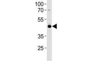 Western Blotting (WB) image for anti-Transcription Factor AP-2 alpha (Activating Enhancer Binding Protein 2 Alpha) (TFAP2A) (AA 104-133) antibody (ABIN3031038)