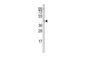Western blot analysis of anti-IRF8 Antibody in Jurkat cell line lysates (35ug/lane) (IRF8 Antikörper  (AA 241-269))