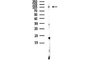 Western blot analysis of lysates from HUVEC cells(LPS,4h treatment), using Phospho-DNMT3A (Ser390/Ser393) Antibody at 1/1000 dilution.