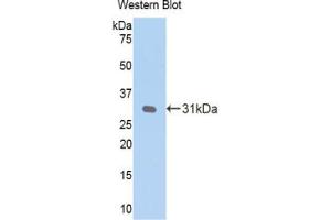 Western blot analysis of the recombinant protein. (CRP Antikörper  (AA 20-225))