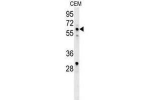 Western blot analysis in CEM cell line lysates (35ug/lane) using IKZF1/IKAROS Antibody (C-term). (IKZF1 Antikörper  (C-Term))